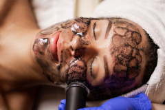oxygeneo-face-treatment